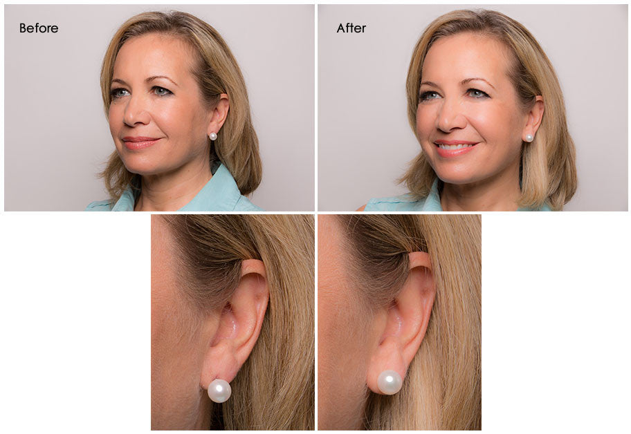 These Levears Earring Lifts Changed My Life — Best Earring Backs